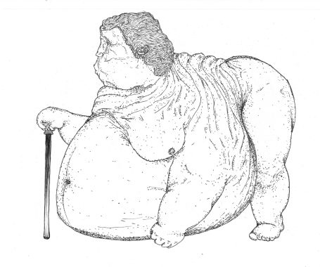 Eine übergewichtige, alte Person mit Gehstock steht mit einem nach vorne geneigten Oberkörper.